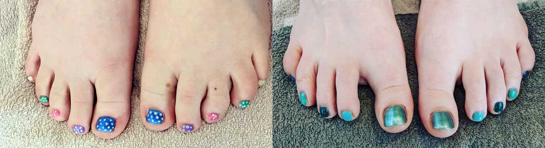 Pedicures Norwich